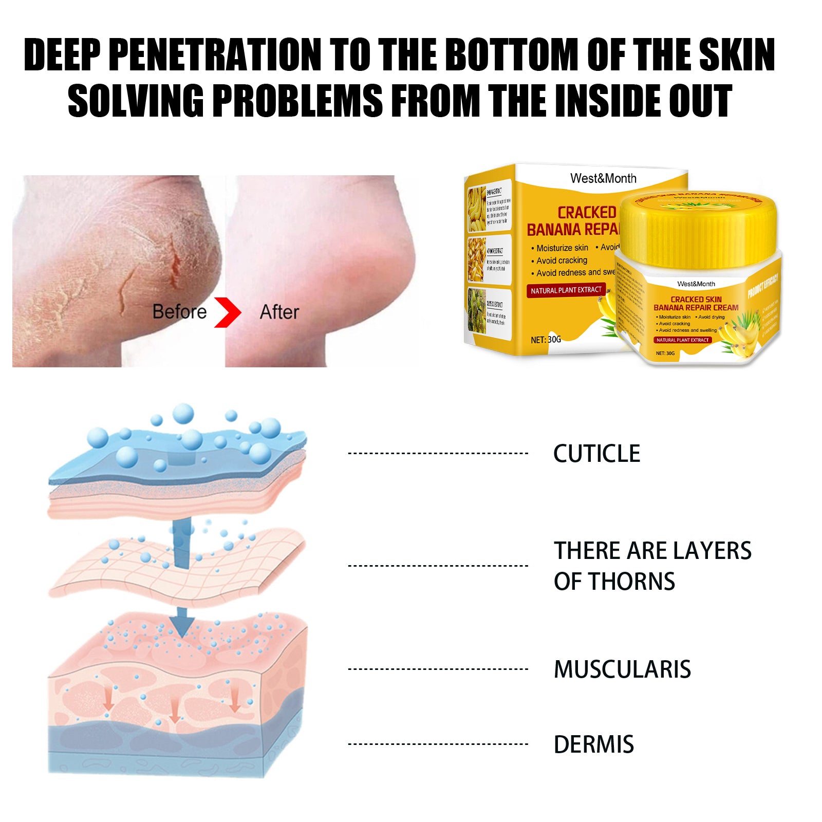 Cracked Skin Banana Nourishing And Moisturizing Foot Repair Cream