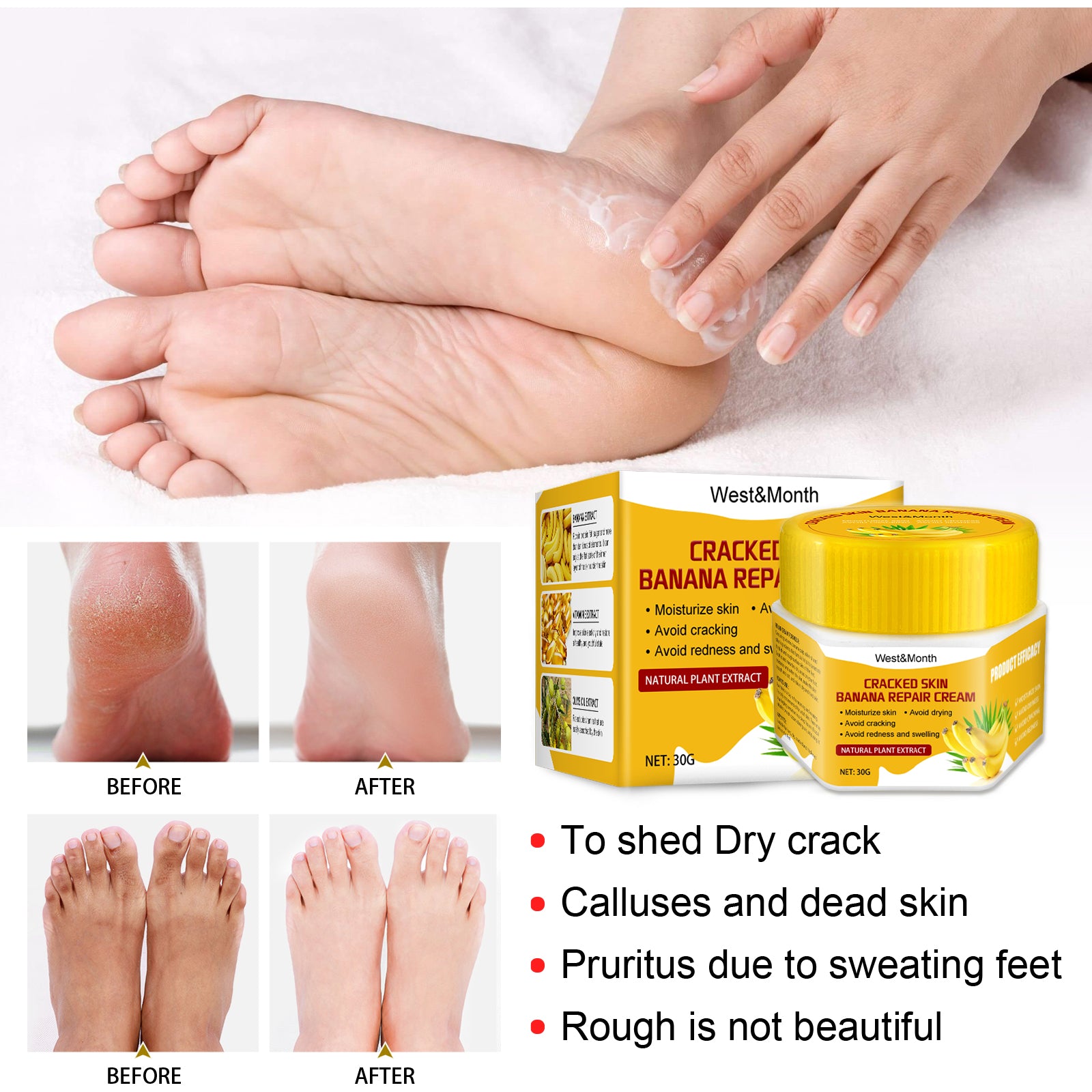Cracked Skin Banana Nourishing And Moisturizing Foot Repair Cream