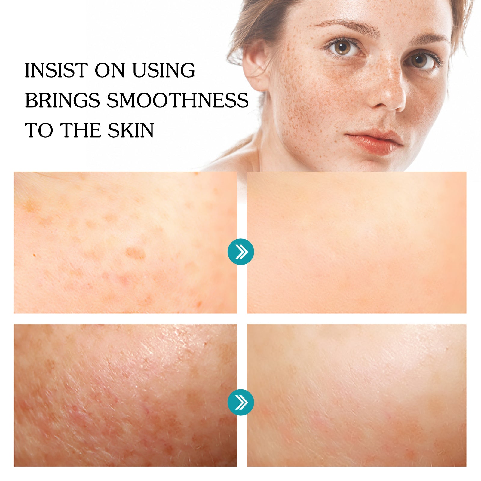 Niacinamide Face Serum
